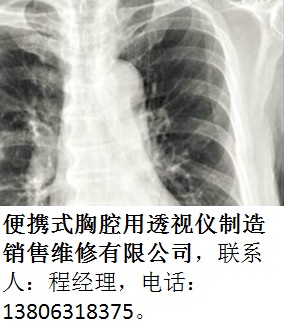 便攜式胸腔用透shi儀