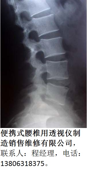 便攜式腰椎用透shi儀