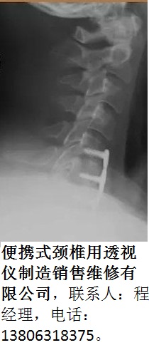 便攜式頸椎用透shi儀