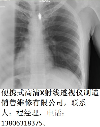 便攜式體檢用透shi儀