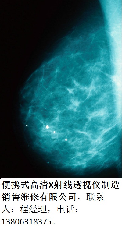 便攜式婦女乳腺檢測用透shi儀