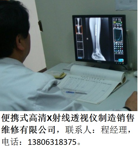 便攜式高清腳踝關(guān)節(jié)用透shi儀