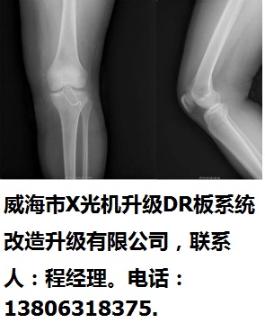 威海市X光機(jī)升級(jí)DR板系統(tǒng)改造升級(jí)