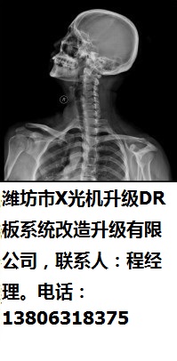 濰坊市X光機(jī)升級(jí)DR板系統(tǒng)改造升級(jí)