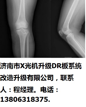 濟(jì)南市X光機(jī)升級DR板系統(tǒng)改造升級