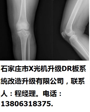 石家莊市X光機升級DR板系統(tǒng)改造升級