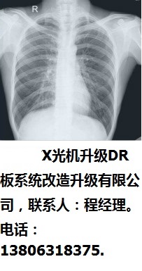 南京市X光機(jī)升級(jí)DR板系統(tǒng)改造升級(jí)