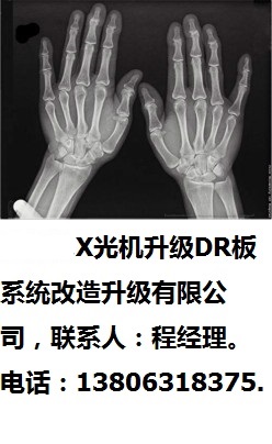 蘇州市X光機(jī)升級(jí)DR板系統(tǒng)改造升級(jí)