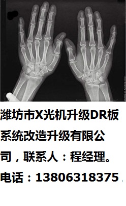 甯稿窞甯俋鍏夋(j墨)鍗囩礆(j铆)DR鏉跨郴绲�(t菕ng)鏀归€犲崌绱�(j铆)