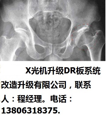 南通市X光機(jī)升級DR板系統(tǒng)改造升級