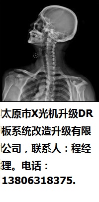 上海市X光機升級DR板系統(tǒng)改造升級