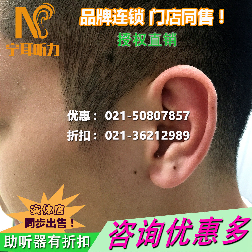 上海徐匯配助聽(tīng)器哪里好