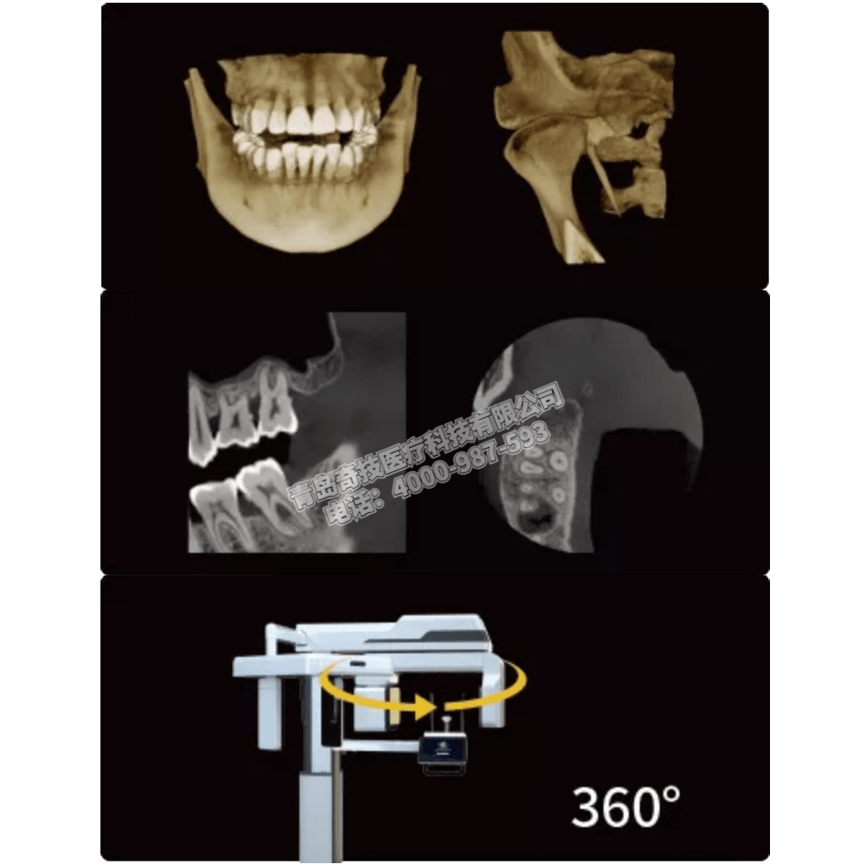 湖北口腔CBCT 全景機(jī)LARGEV國(guó)產(chǎn)朗視產(chǎn)品介紹