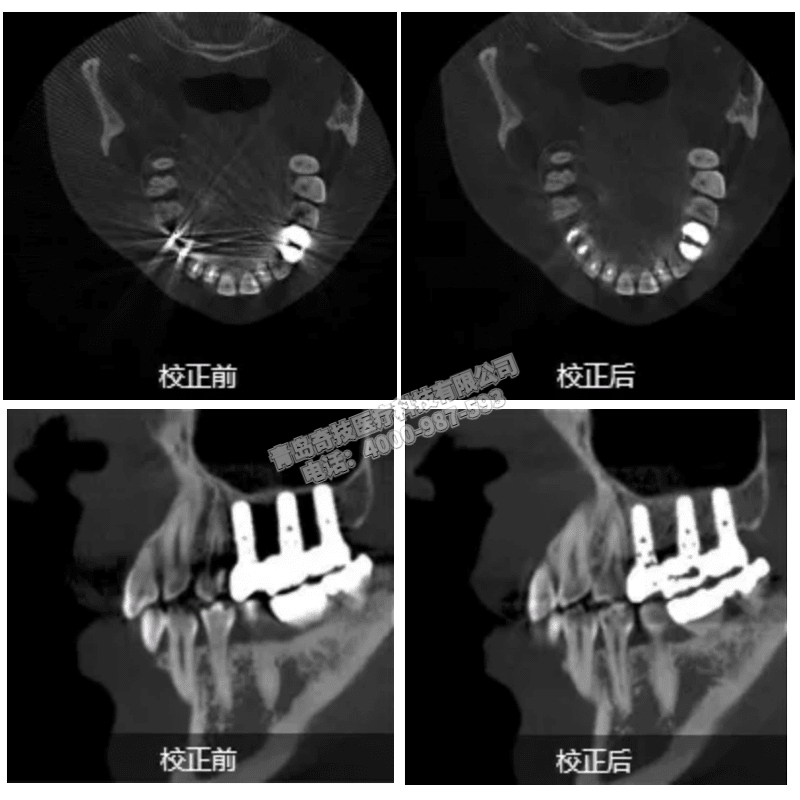 福建口腔CBCT 全景機(jī)LARGEV國(guó)產(chǎn)朗視產(chǎn)品介紹