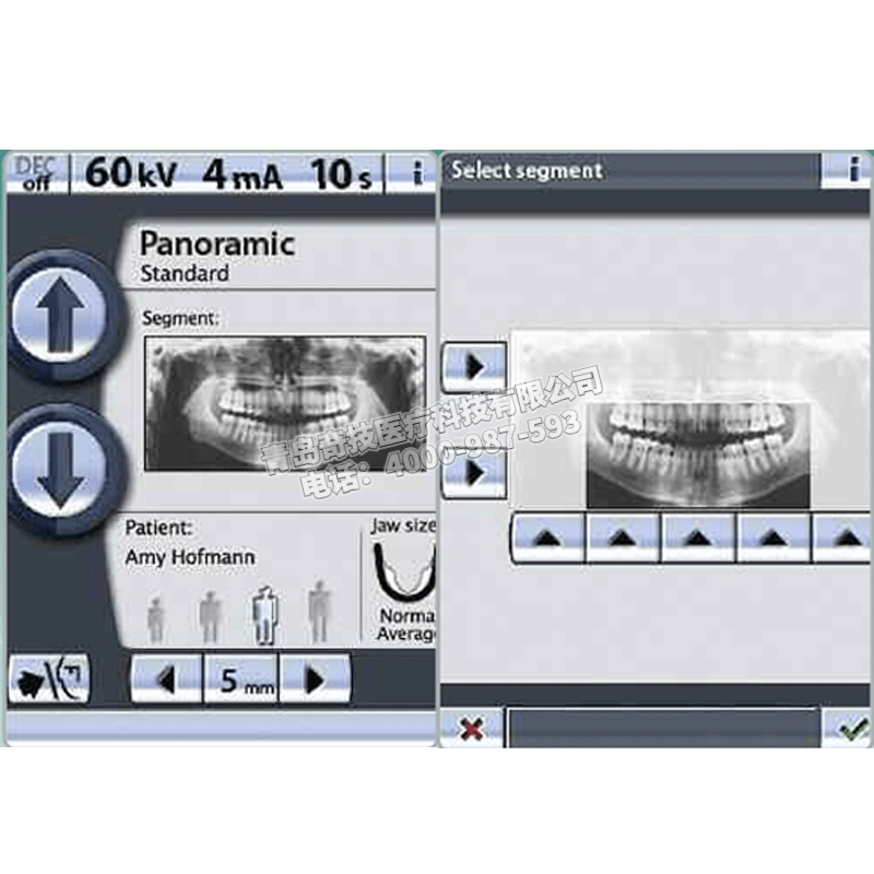 安徽口腔全景機CBCT牙科CT芬蘭普蘭梅卡產(chǎn)品介紹ProOne