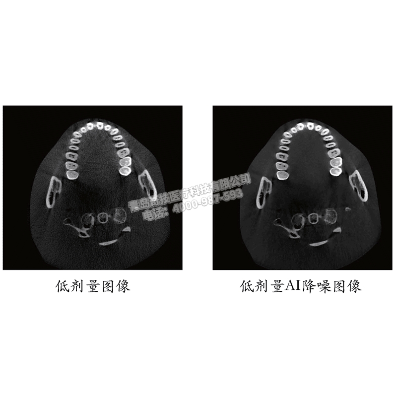 山東中大視野伯恩登特伯爵M/S口腔全景機(jī)牙科CBCT