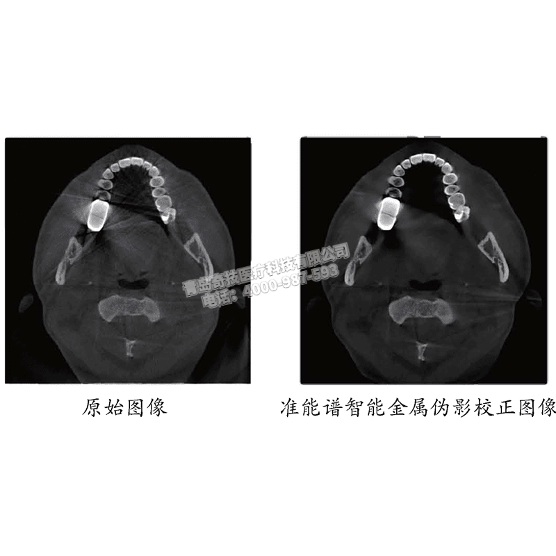 吉林口腔CBCT 口腔全景機博恩登特產品介紹