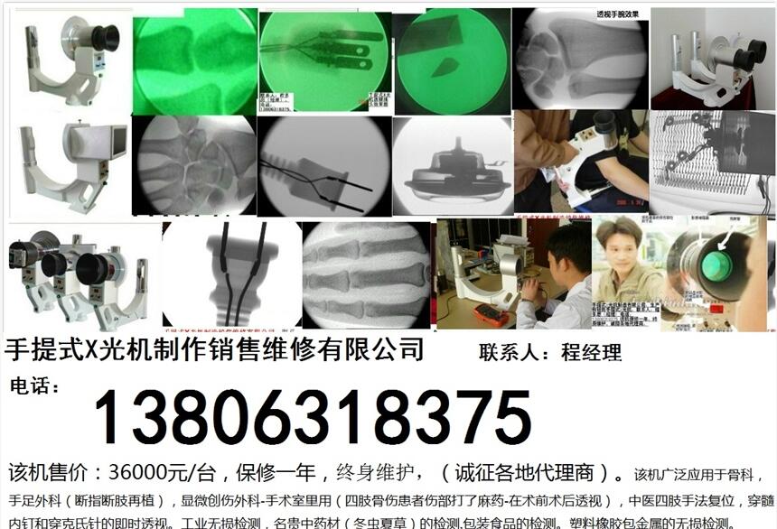 骨科用手提式X光機