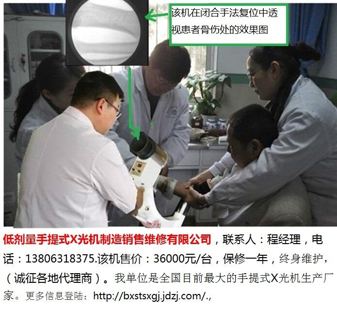 中醫(yī)正骨醫(yī)院用手提式X光機(jī)