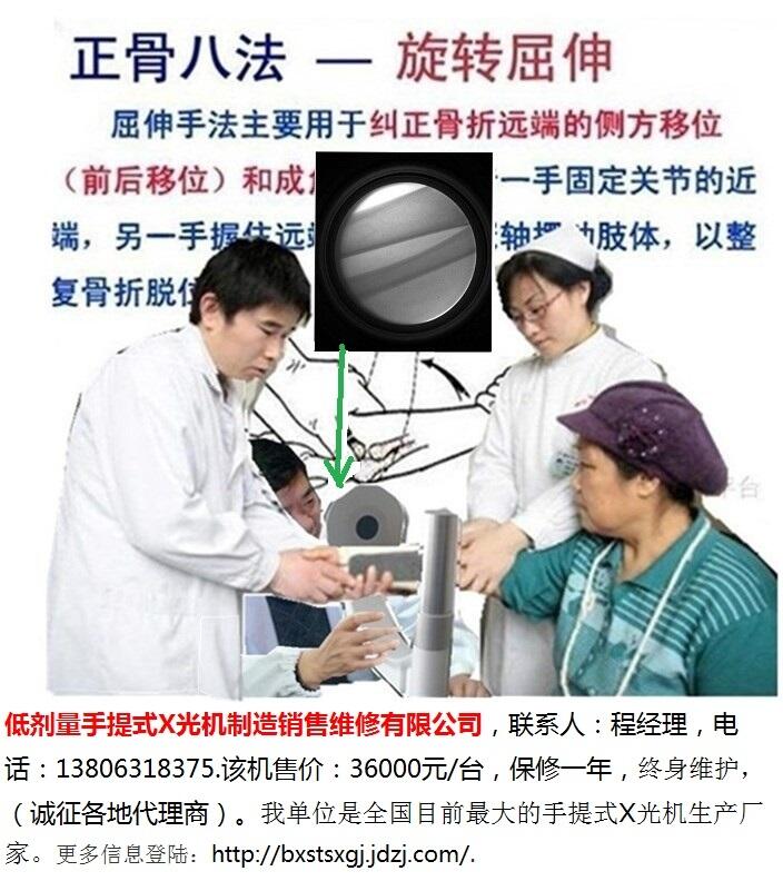 手法復位閉合穿針用便攜式X光機