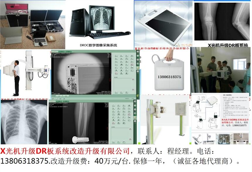 滁州市X光機(jī)升級(jí)DR板系統(tǒng)改造升級(jí)