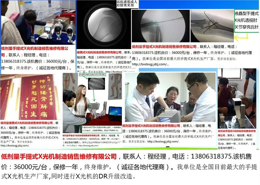 X光機(jī)/手提式X光機(jī)/便攜式X光機(jī)/便攜式X射線機(jī)