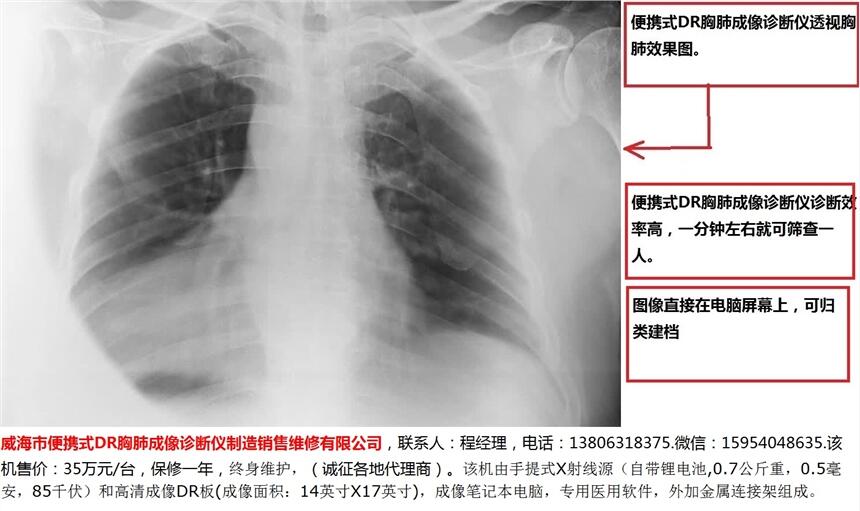 威海市便攜式DR胸肺成像診斷儀制造銷售維修有限公司