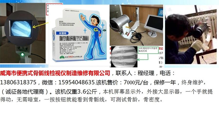 便攜式骨骺線檢視儀1