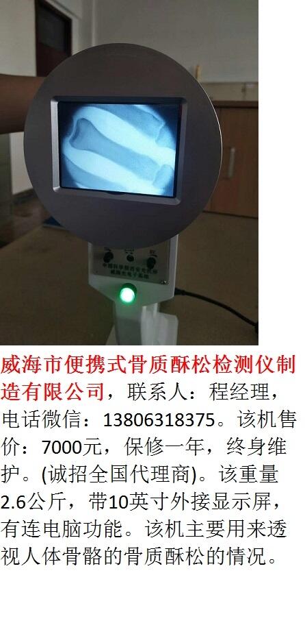 威海市便攜式骨質(zhì)酥松檢測儀制造有限公司