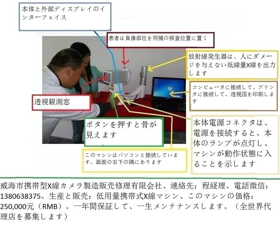 ポータブルX線