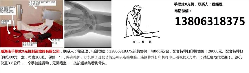 烏魯木齊市手提式X光機(jī)一三八零六三一八三七五程經(jīng)理