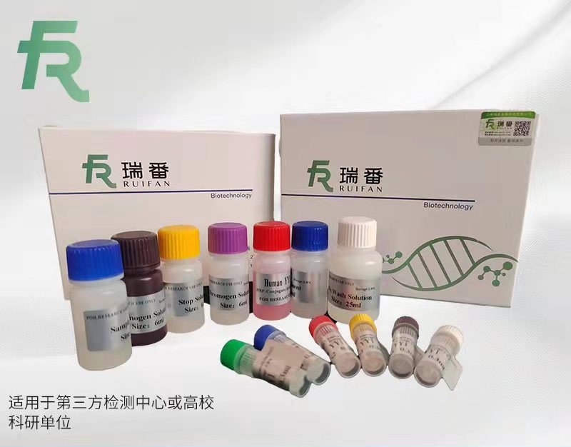 人細胞色素P4501A1（CYP1A1）ELISA試劑盒