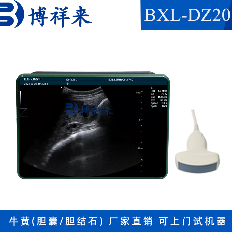 博祥來新款牛黃b超檢測儀超聲診斷儀器可上門試機器